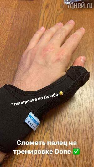 Давид Манукян сломал палец Давид Манукян сломал палец