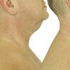 Холка: из-за чего возникает и как ее убрать в домашних условиях? Холка: из-за чего возникает и как ее убрать в домашних условиях?