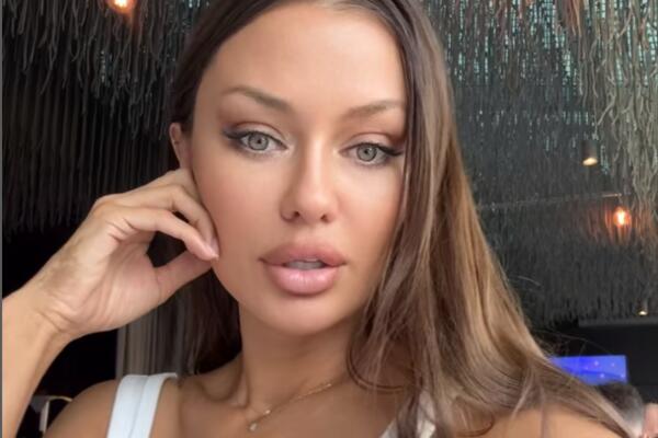 Боня рассказала о проблемах с лицом после пластики — началось обвисание