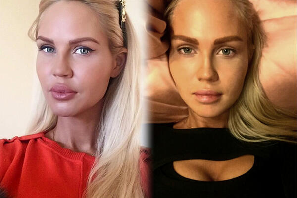 Жена футболиста Павла Погребняка уменьшила губы