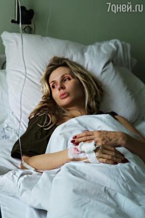 Травмы Светланы Лободы