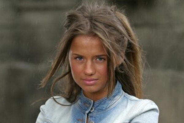 Звезда «Фабрики звезд» напугала «изуродованным» лицом