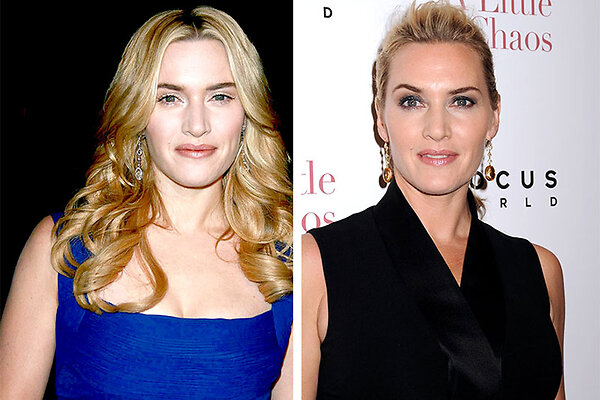 Мы их теряем: звезды, которые кардинально меняют лицо пластикой