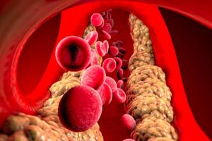 8 мифов о холестерине: развеем вместе с кардиологом