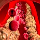 8 мифов о холестерине: развеем вместе с кардиологом