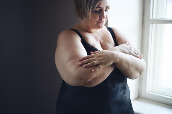 У россиян подтвердилась зависимость ожирения от генетики