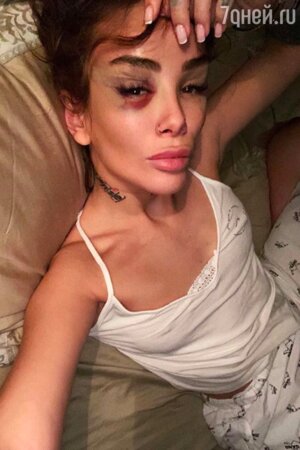 Айза Анохина