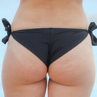 Пятое чувство: ягодицы могут предсказать развитие диабета второго типа