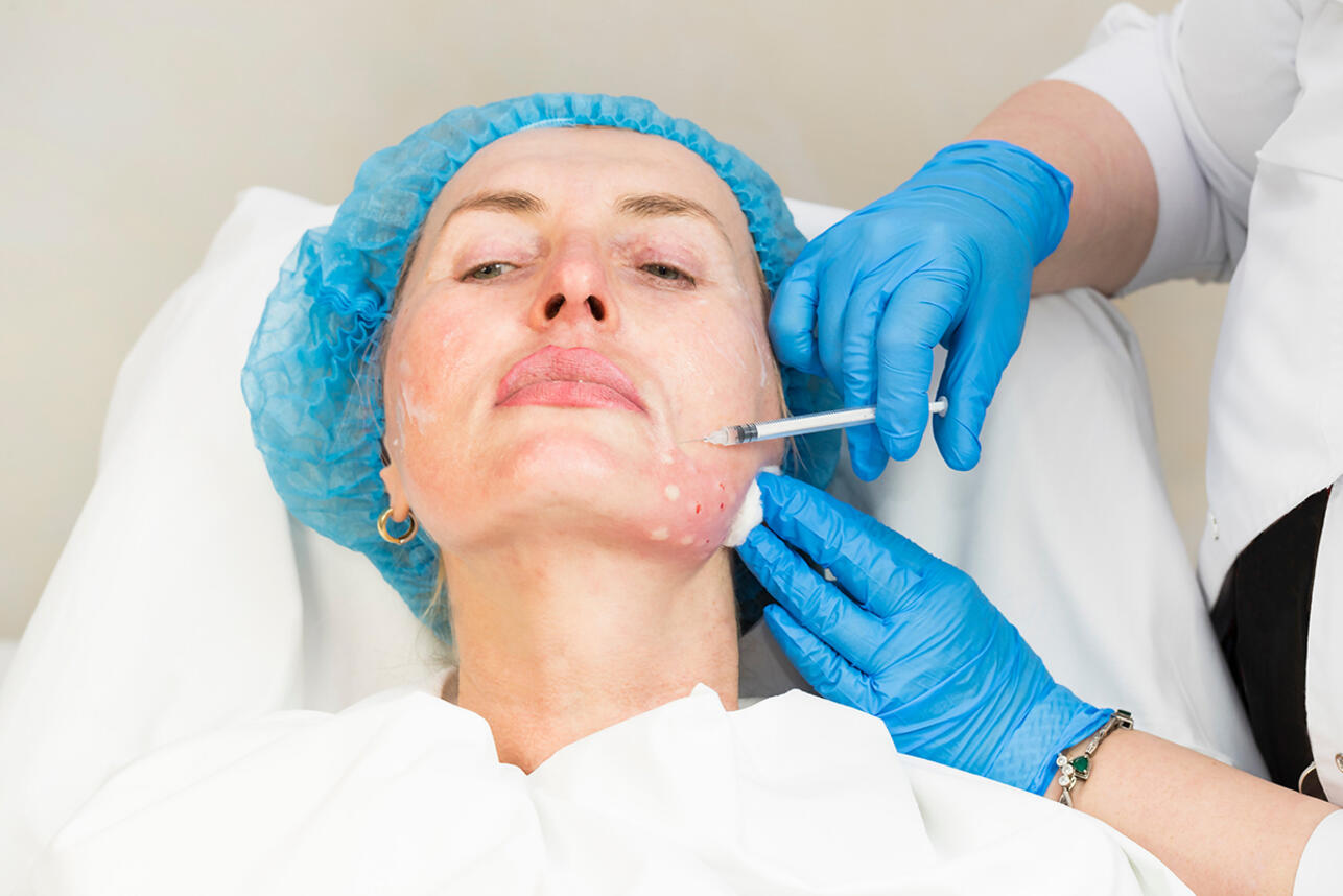 инъекционно методом мезотерапии или биоревитализации