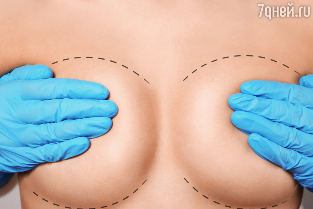 грудь операция