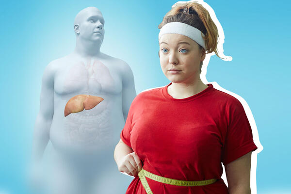 Жировой гепатоз: как проблемы с печенью могут повлиять на вес 