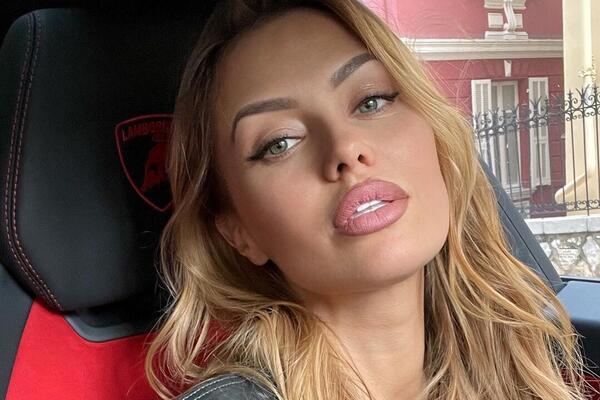 Лицо заплыло, глаз не видно: вид Бони после операции поразил публику