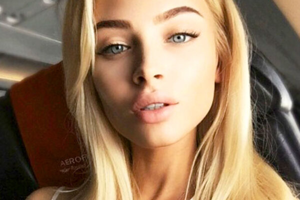 Алена Шишкова опровергла слухи о повторной пластике груди 