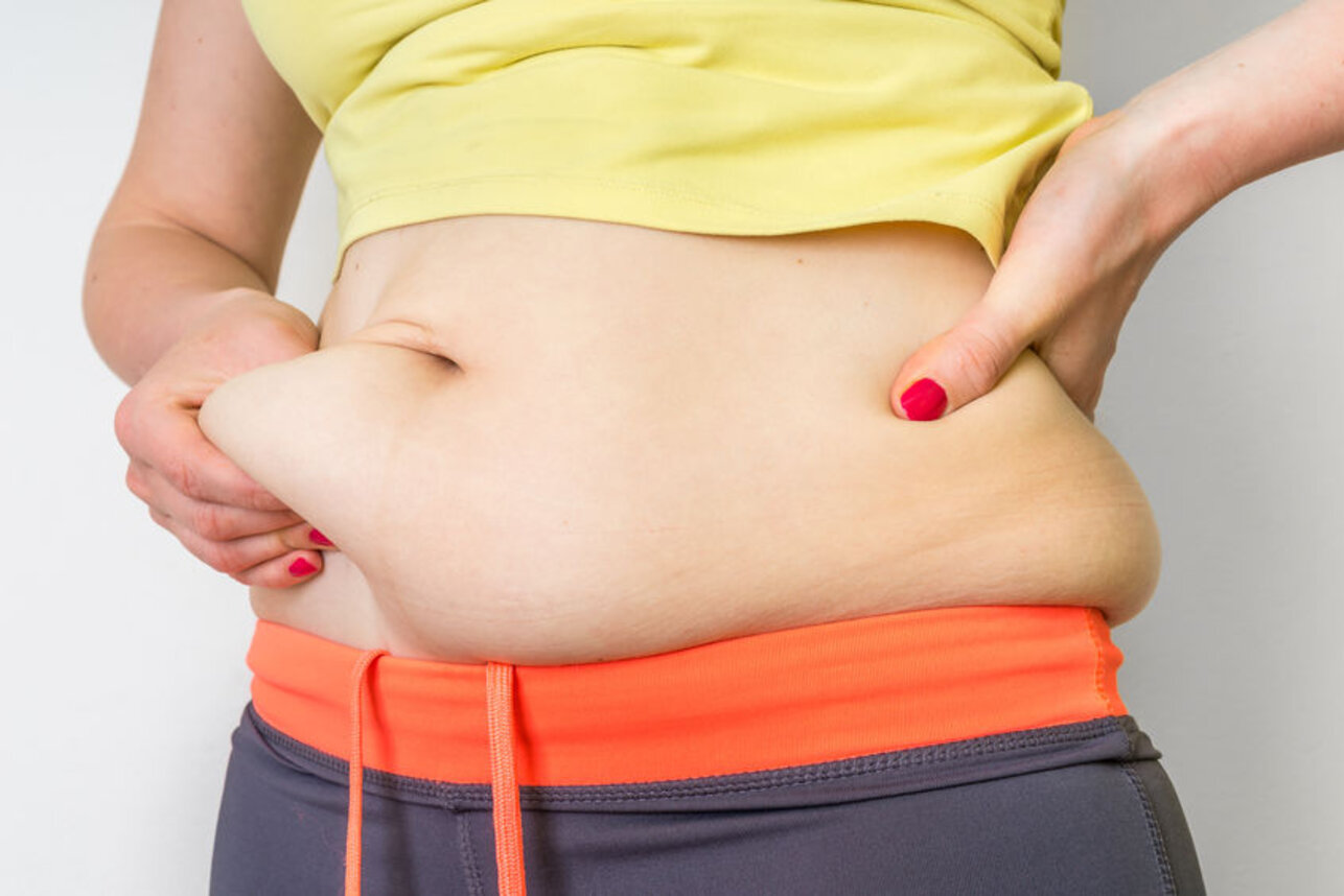 Ожирение в области живота у женщин