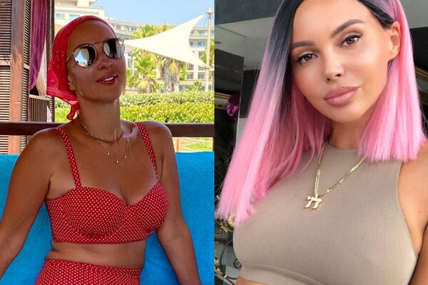 Самойлова, Кудрявцева и другие звезды, заговорившие о проблемах после пластики