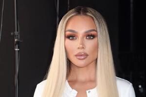 Располневшая Анна Седокова поедает ночами пельмени — о диете и не помышляет