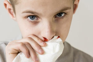 Гематолог рассказал, почему зимой кровь из носа может идти чаще