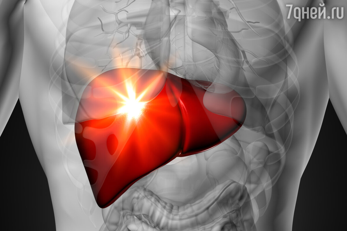 Печень: почему она не болит, даже когда уже серьезно больна - 7Дней.ру