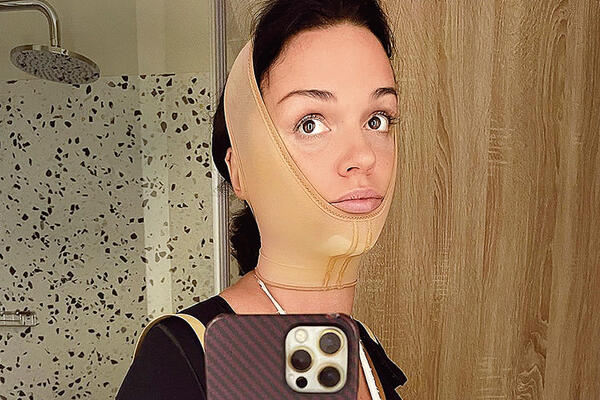 «Вдруг я умру»: Слава сделала откровенное признание по поводу своей пластики