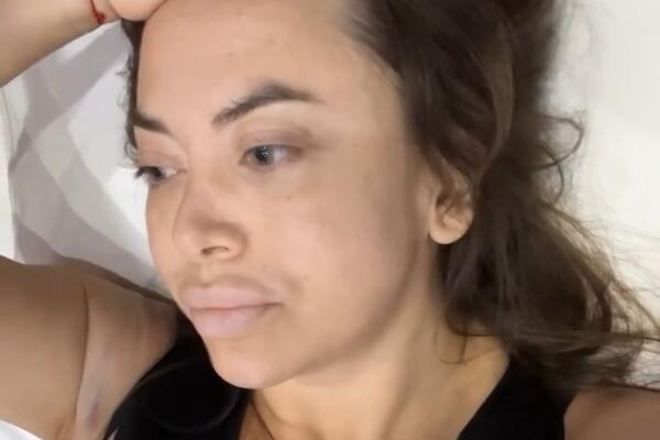 Фриске перенесла экстренную операцию: «Что за год!»