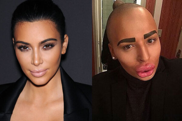 Мужчина потратил 150 тысяч долларов на сходство с Ким Кардашьян