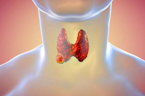 Рак щитовидной железы: как вовремя распознать и предотвратить