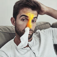 Вечный гайморит: почему лекарства не помогают и когда нужна операция