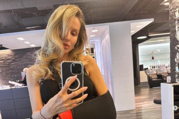 «Переставляет гипс»: Лободу заподозрили в обмане после операции