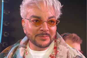 Пострадавший Киркоров показал жуткий шрам на руке от ожога — затянулся не до конца