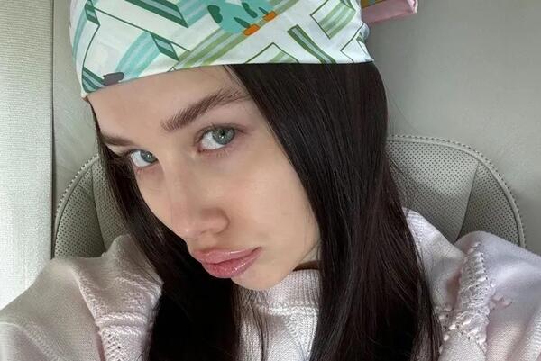 «Я с новым носом»: 18-летняя невеста Лепса показала себя после пластики