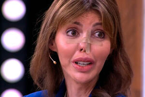 Изуродованная недугом экс-жена Аршавина снова стала красоткой