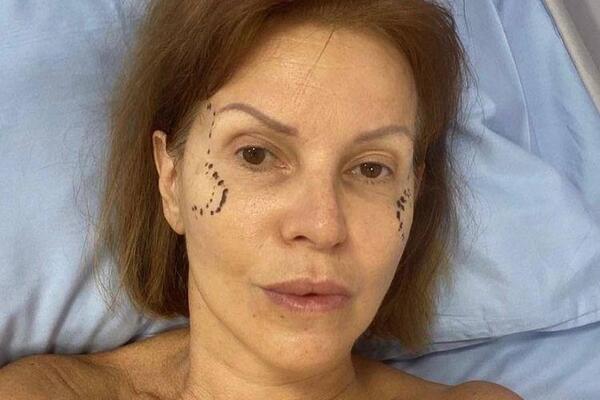 Зрелище не для слабонервных: обругавшая Киркорова Штурм показала кадры с липосакции 