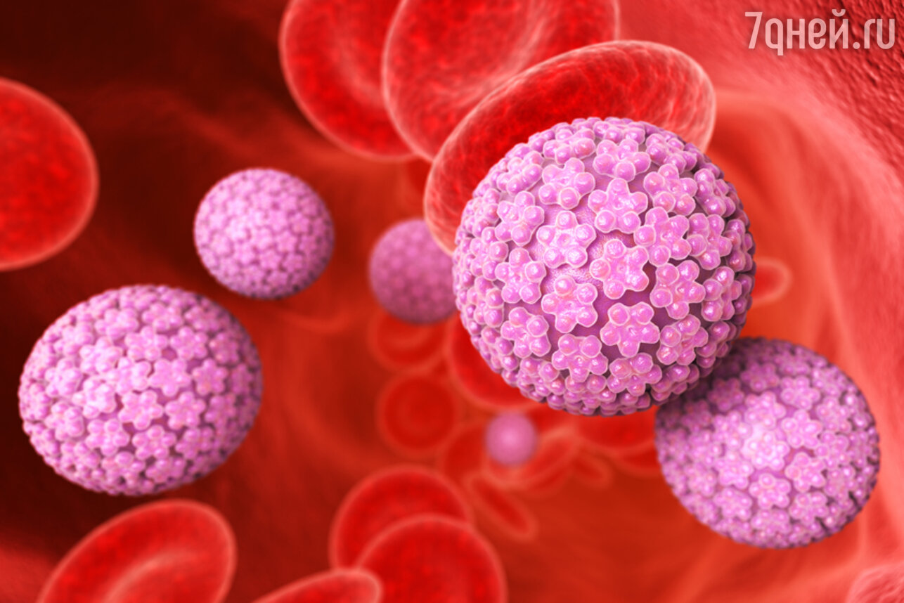 Emberi papilloma vírus ember - A HPV (humán papillomavírus) fertőzés tünetei, kezelése