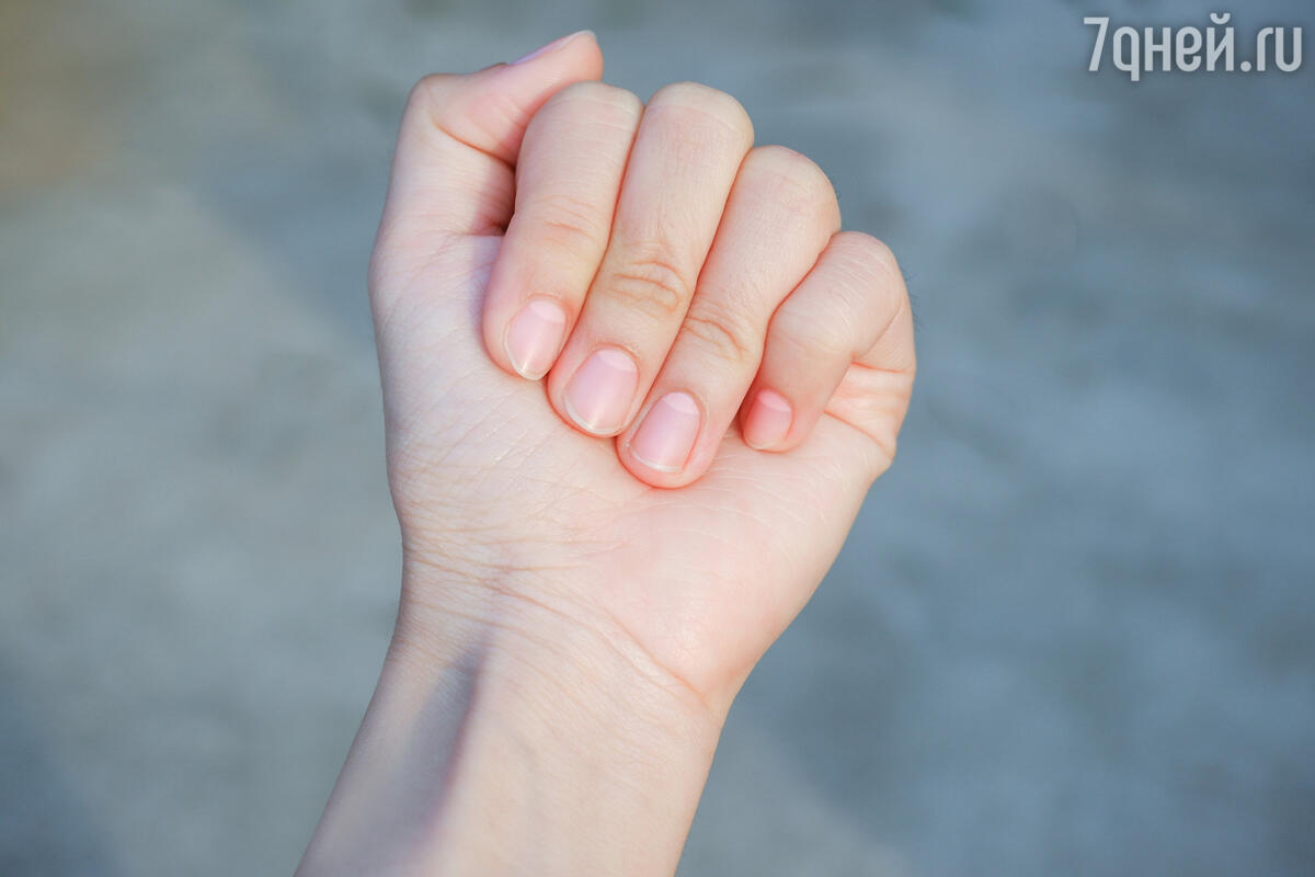 Что говорят ногти о здоровье человека: 12 тревожных признаков