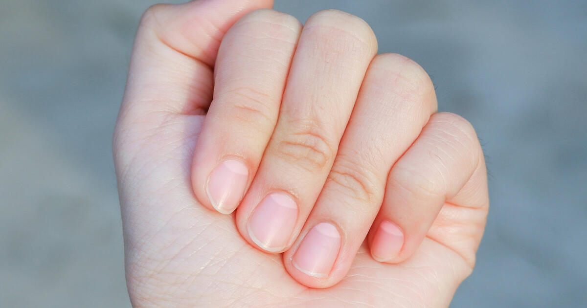 Лунки на ногтях и их значение для здоровья