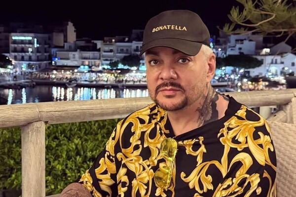 Неузнаваемый Киркоров показал рану на руке —  не заживает уже несколько месяцев