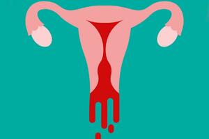 Шрамы не украшают: из менструальной крови сделают лекарство от рубцов