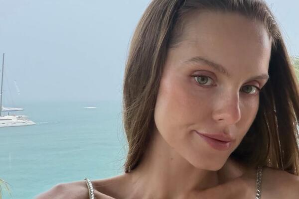 «Укусила какая-то тварь»: Клюкина пострадала во время отпуска на Сейшелах