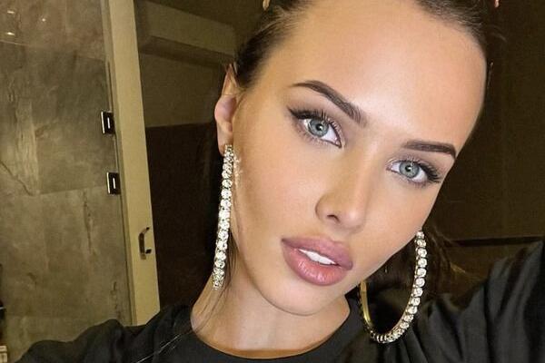 Раскрыта правда про пластику Решетовой — вот как стала копией Алсу