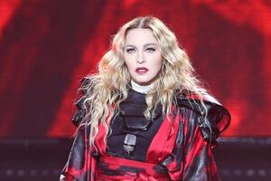 Мадонна похвасталась своим огромным шрамом