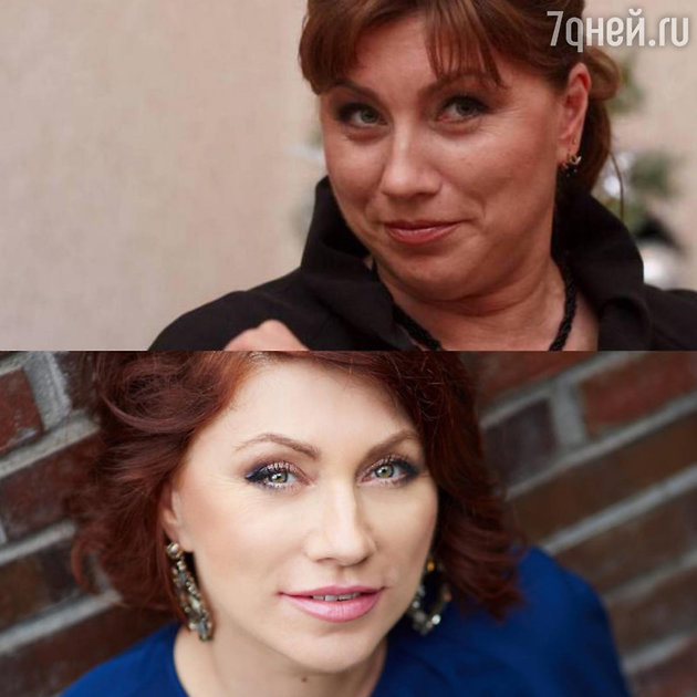 какие звезды не делали пластические операции. Смотреть фото какие звезды не делали пластические операции. Смотреть картинку какие звезды не делали пластические операции. Картинка про какие звезды не делали пластические операции. Фото какие звезды не делали пластические операции