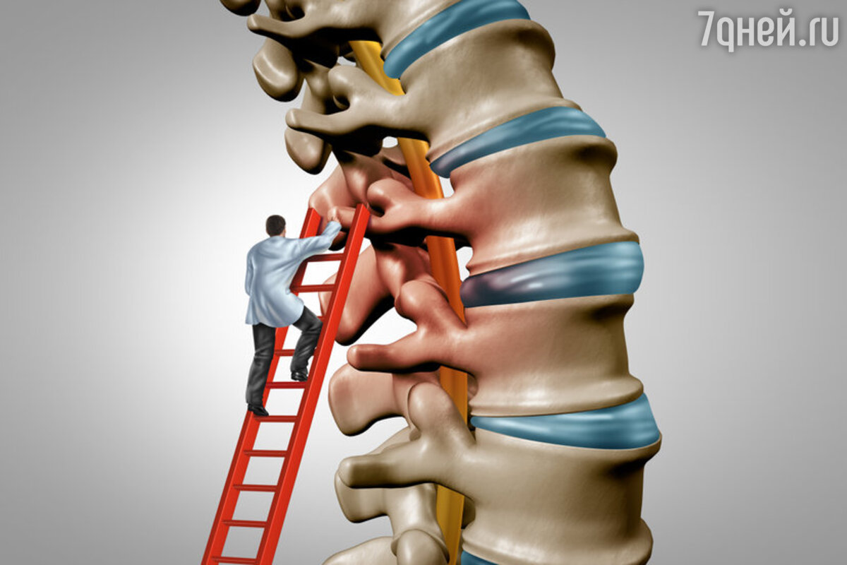 Позвоночник какой врач лестниц
