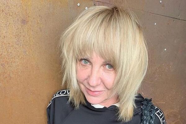 Яковлева сделала подтяжку лица у хирурга Гурченко