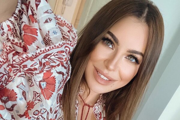 «Что с губами, дива?»: Ани Лорак изменилась до неузнаваемости