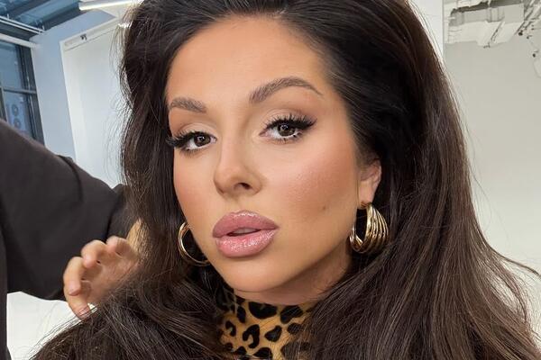 Певица Нюша — про пластику, которая ее преобразила: «Это мне льстит, я хорошо выгляжу»