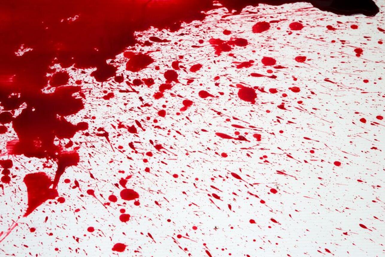 Кровь в соннике Миллера