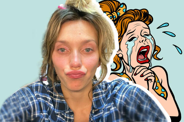 На старые фото без слез не взглянешь: Тодоренко заговорила о пластике