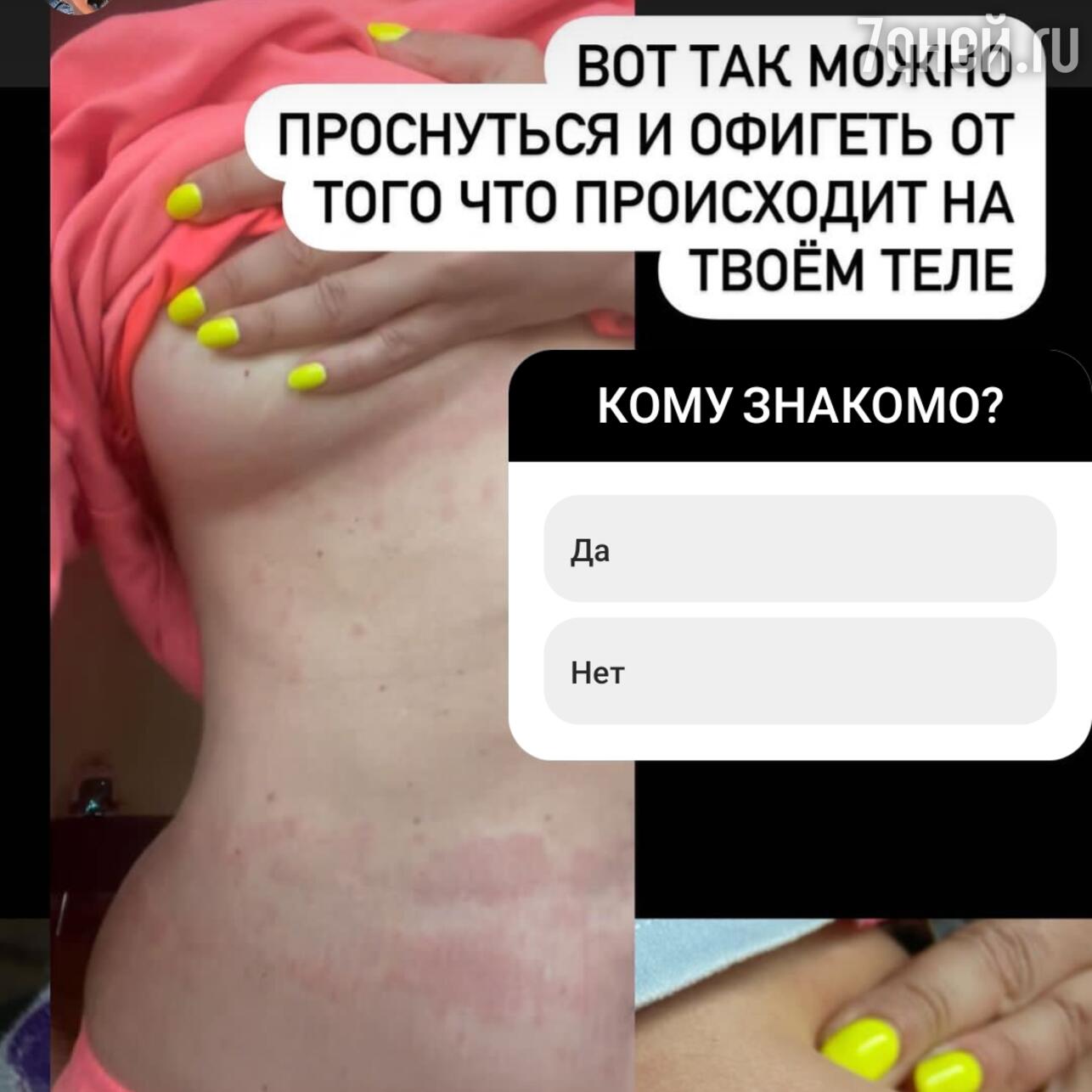 Не для слабонервных»: Наташа Королева показала последствия болезни -  7Дней.ру