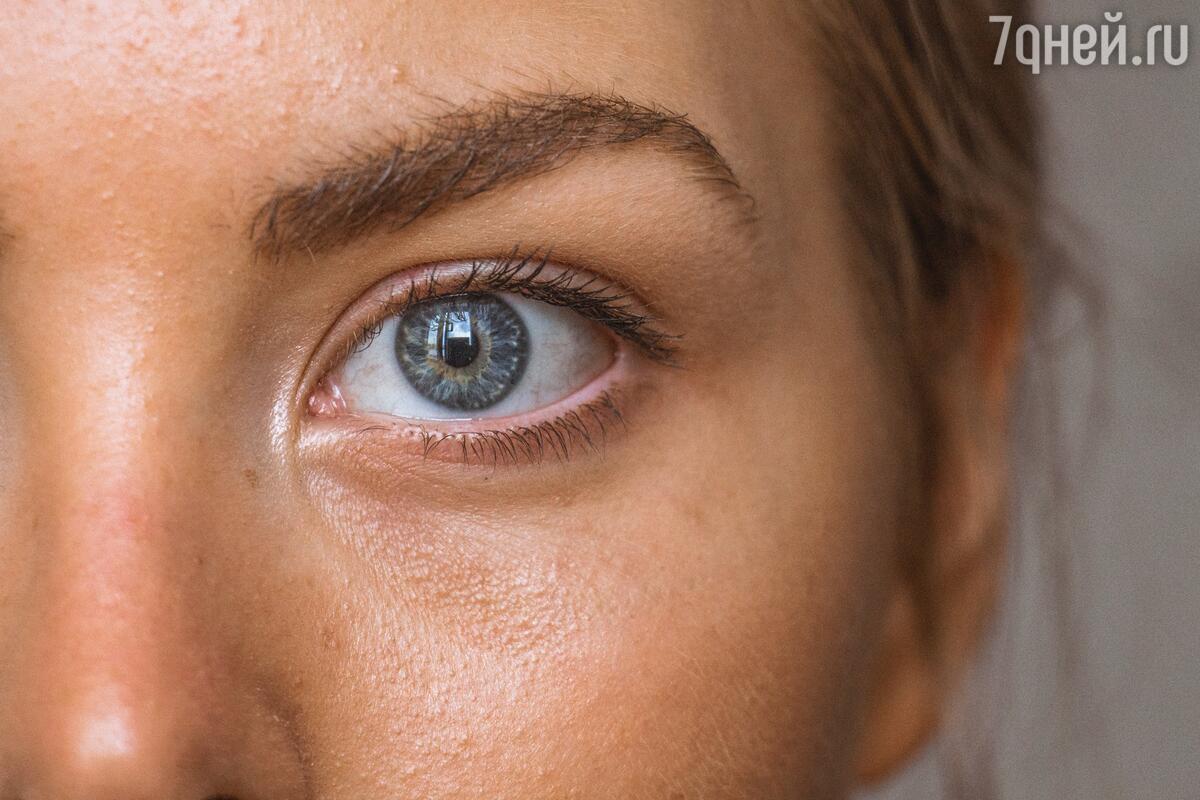 Шелушение под глазами и вокруг глаз — причины и лечение