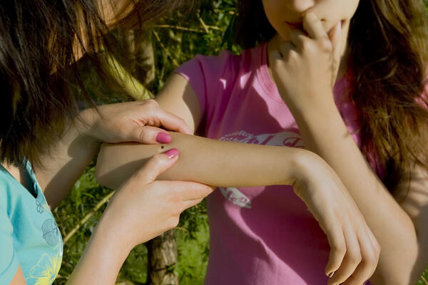 Укус клеща: как себя обезопасить и что делать при обнаружении паразита